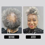 ALOPECIA CARE (ADD-ONS)